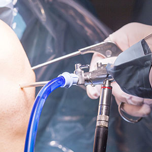 Arthroscopy and Ligament Surgery