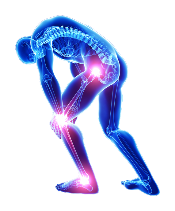 Complex fracture reconstruction